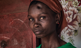 Guinée : Les victimes d’usage illégal de la force en attente de soins et de justice